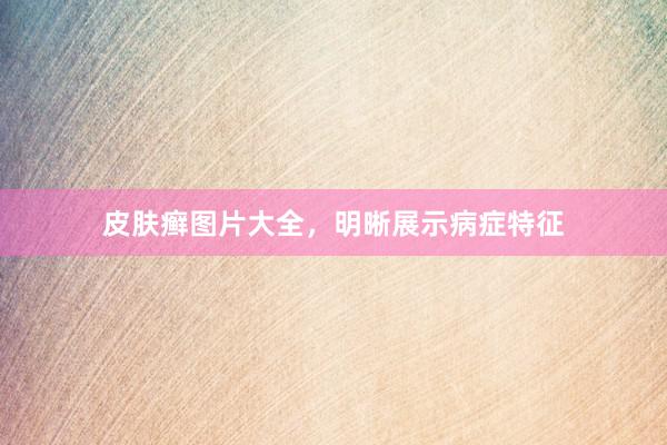 皮肤癣图片大全，明晰展示病症特征
